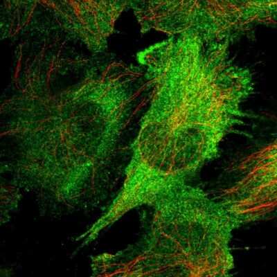 Immunocytochemistry/ Immunofluorescence: CAP2 Antibody [NBP2-30572]