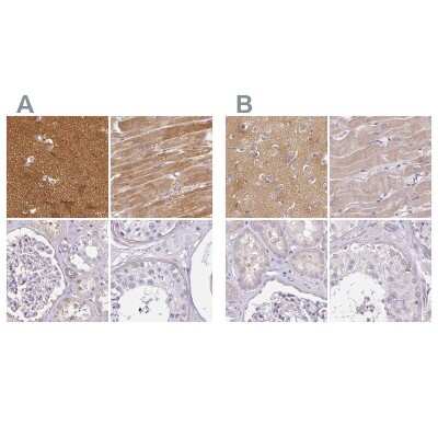 Immunohistochemistry-Paraffin: CAP2 Antibody [NBP2-30572]