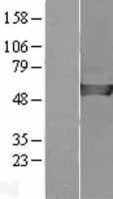 Western Blot: CAP2 Overexpression Lysate [NBL1-08675]