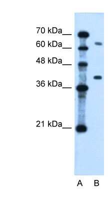 Western Blot: CAPC / LRRC26 Antibody [NBP1-70485]