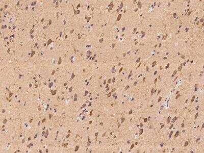 Immunohistochemistry-Paraffin: CAPRIN2 Antibody [NBP3-06021]