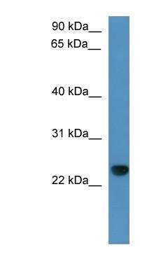 Western Blot: CAPSL Antibody [NBP1-79507]