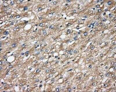 Immunohistochemistry-Paraffin: CAPZA1 Antibody (OTI2G4) [NBP2-02500]