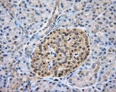 Immunohistochemistry-Paraffin: CAPZA1 Antibody (OTI2G4) [NBP2-02500]