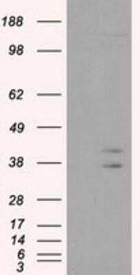 Western Blot: CAPZA1 Antibody (OTI2G4) [NBP2-02500]