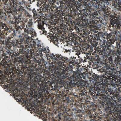 Immunohistochemistry-Paraffin: CAPZA2 Antibody [NBP1-86632]