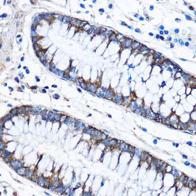 Immunohistochemistry-Paraffin: CAPZA2 Antibody - Azide and BSA Free [NBP2-92643]
