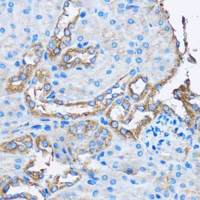 Immunohistochemistry-Paraffin: CAPZA2 Antibody - Azide and BSA Free [NBP2-92643]