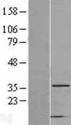 Western Blot: CAPZA2 Overexpression Lysate [NBL1-08691]