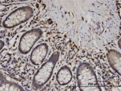Immunohistochemistry-Paraffin: CAPZB Antibody (1H1) [H00000832-M02]