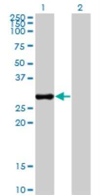 Western Blot: CAPZB Antibody (4H8) [H00000832-M03]