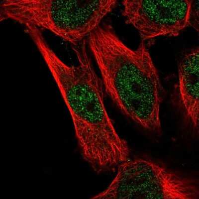 Immunocytochemistry/ Immunofluorescence: CAPZB Antibody [NBP2-54936]