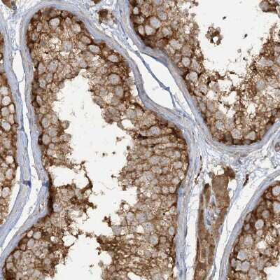 Immunohistochemistry-Paraffin: CAPZB Antibody [NBP1-85922]