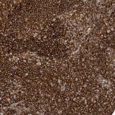 Immunohistochemistry-Paraffin: CAPZB Antibody [NBP1-85922]