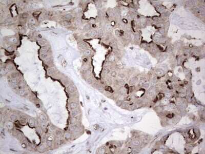 Immunohistochemistry: CAR/NR1I3 Antibody (OTI1C6) [NBP2-46226]