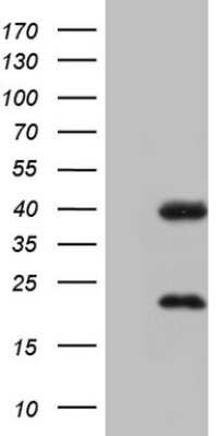 Western Blot: CAR/NR1I3 Antibody (OTI1C6) [NBP2-46226]