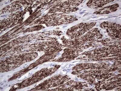 Immunohistochemistry: CAR/NR1I3 Antibody (OTI1C6) - Azide and BSA Free [NBP2-71525]