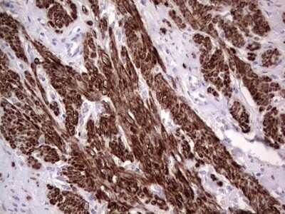 Immunohistochemistry: CAR/NR1I3 Antibody (OTI1C6) - Azide and BSA Free [NBP2-71525]