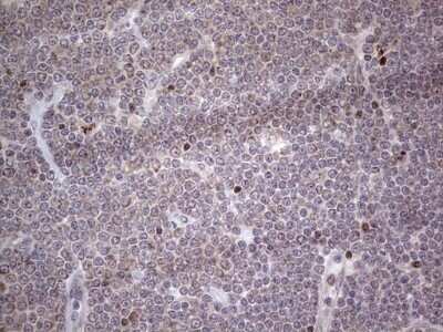 Immunohistochemistry: CAR/NR1I3 Antibody (OTI1C6) - Azide and BSA Free [NBP2-71525]