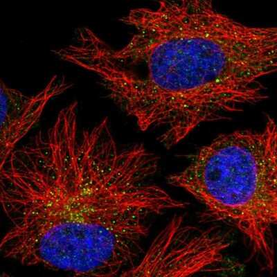 Immunocytochemistry/ Immunofluorescence: CARD10 Antibody [NBP2-55720]