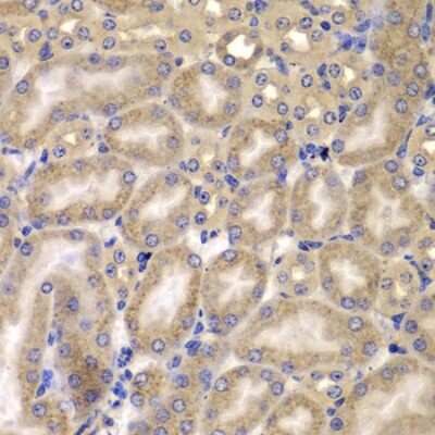 Immunohistochemistry-Paraffin: CARD10 Antibody - BSA Free [NBP2-92911]
