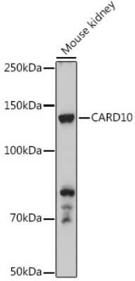 Western Blot: CARD10 AntibodyBSA Free [NBP2-92911]