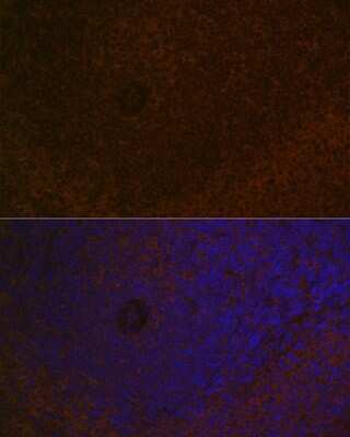 Immunohistochemistry: CARD11/CARMA1 Antibody (8N4C9) [NBP3-16849]