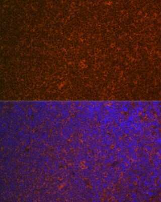 Immunohistochemistry: CARD11/CARMA1 Antibody (8N4C9) [NBP3-16849]