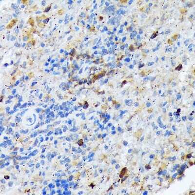 Immunohistochemistry-Paraffin: CARD11/CARMA1 Antibody (8N4C9) [NBP3-16849]