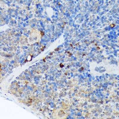 Immunohistochemistry-Paraffin: CARD11/CARMA1 Antibody (8N4C9) [NBP3-16849]