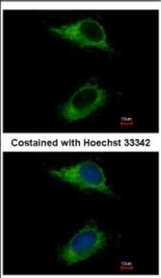 Immunocytochemistry/ Immunofluorescence: CARD6 Antibody [NBP2-15704]