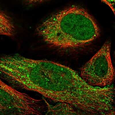 Immunocytochemistry/ Immunofluorescence: CARD8 Antibody [NBP2-47527]