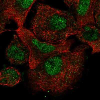 Immunocytochemistry/ Immunofluorescence: CARD8 Antibody [NBP2-47528]
