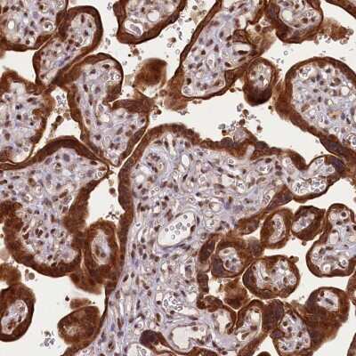 Immunohistochemistry-Paraffin: CARD8 Antibody [NBP2-47527]
