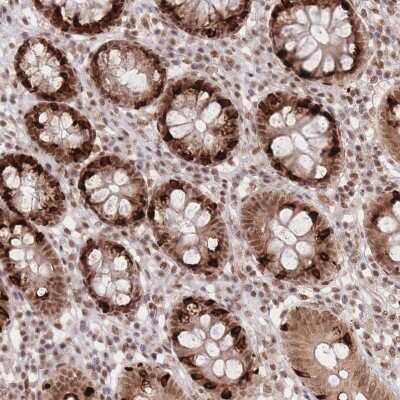 Immunohistochemistry-Paraffin: CARD8 Antibody [NBP2-47528]