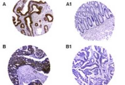 Immunohistochemistry-Paraffin: CARD8 Antibody [NB100-56181]