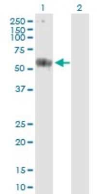 Western Blot: CARD9 Antibody [H00064170-B01P]