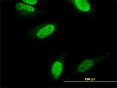 Immunocytochemistry/ Immunofluorescence: CARF/CDKN2AIP Antibody (2E6) [H00055602-M04]