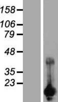 Western Blot: CARHSP1 Overexpression Lysate [NBP2-07354]