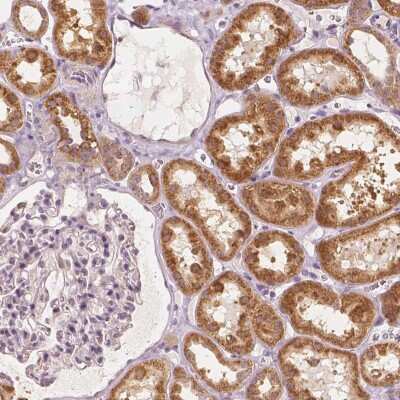Immunohistochemistry-Paraffin: CARKL Antibody [NBP2-49429]