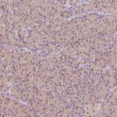 Immunohistochemistry-Paraffin: CARKL Antibody [NBP2-49429]