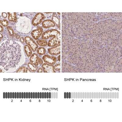 Immunohistochemistry-Paraffin: CARKL Antibody [NBP2-49429]