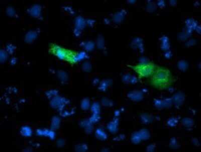 Immunocytochemistry/ Immunofluorescence: CARKL Antibody (OTI3D7) - Azide and BSA Free [NBP2-71771]