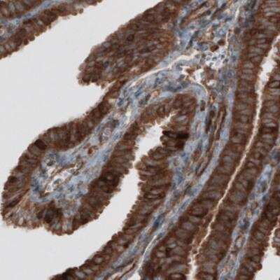 Immunohistochemistry: CARS Antibody (CL2302) [NBP2-36755]