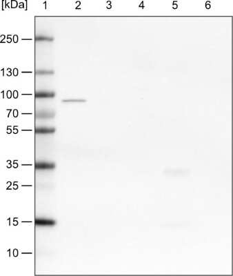 Western Blot: CARS Antibody (CL2304) [NBP2-36756]