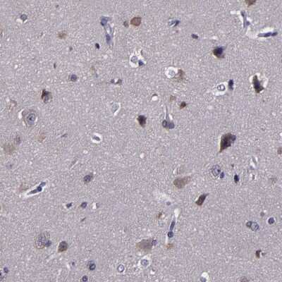 Immunohistochemistry-Paraffin: CARS Antibody [NBP1-86623]
