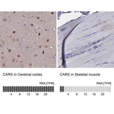 Immunohistochemistry-Paraffin: CARS Antibody [NBP1-86624]