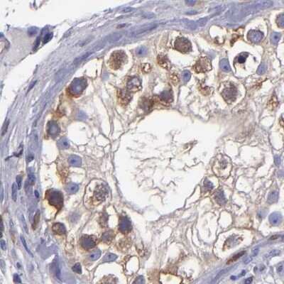 Immunohistochemistry-Paraffin: CARS Antibody [NBP1-86624]