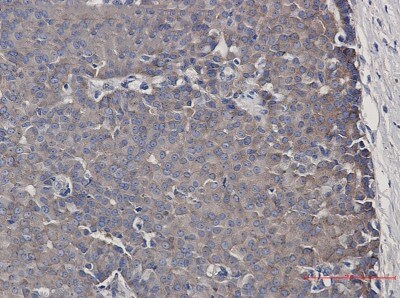 Immunohistochemistry-Paraffin: CARS Antibody (S01-7D4) [NBP3-19844]