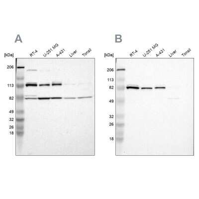 Western Blot: CARS Antibody [NBP1-86623]